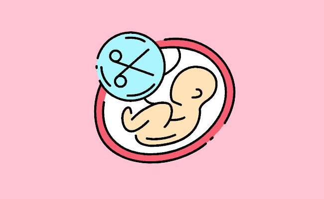 no to abortion photo